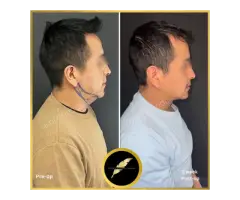 Aesthetic & Cosmetic Surgeon in Los Angeles Dr. Saurabh Jain - 10