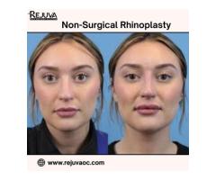 Non-surgical Rhinoplasty Newport Beach for Natural Enhancement