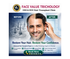 Before & After Hair Transplant Results in Chennai Restore Your Confidence