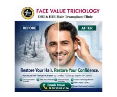 Before & After Hair Transplant Results in Chennai Restore Your Confidence