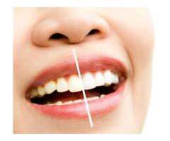 Professional Teeth Whitening PA Services Delivering Brighter Smiles