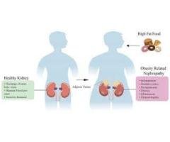 Kidney disease care