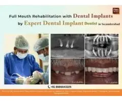 Best Implant Dentist in Secunderabad FMS Dental