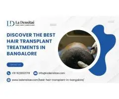 Discover the Best Hair Transplant Treatments in Bangalore