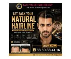 Get Back Your Natural Hairline with Advanced HDI Technology