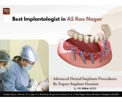 Best Implantologist in AS Rao Nagar FMS Dental