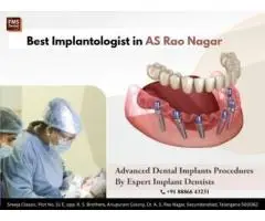 Best Implantologist in AS Rao Nagar FMS Dental