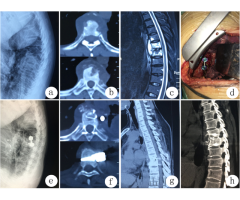 Spine Surgeon in Kozhikode, Kerala - 2