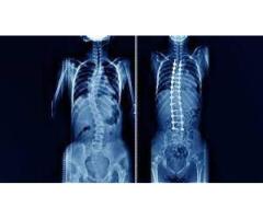Spine Surgeon in Kozhikode, Kerala - 7