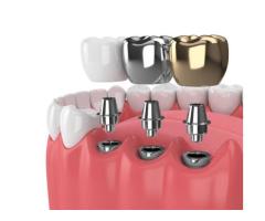 Best Dental Clinic in Madurai Near Me for Advanced Care