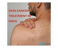 Skin Cancer Treatment in India