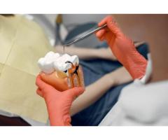 Root Canals Bristol PA Trusted Care for Lasting Tooth Pain Relief and Healthy Smiles