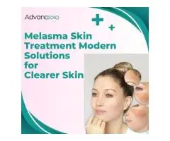 Melasma Skin Treatment Modern Solutions for Clearer Skin