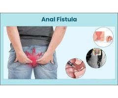 Permanent Relief with Expert Ayurvedic Piles & Fissure Care in Delhi