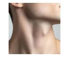 Neck Lift Surgery in Los Angeles - 2