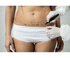 Best Liposuction Clinic in Gurgaon for Body Transformation