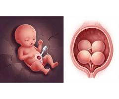 Male Infertility Treatment in Sonipat