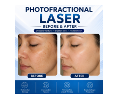 Explore Advanced Laser Options for Skin Renewal and Clarity