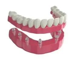 Comfortable Dentures in Bristol PA for a Natural Looking Confident and Healthy Smile