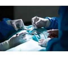 Myomectomy for Fibroids Surgery in Delhi
