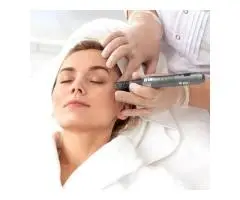 Microneedling Tampa for Smoother and Healthier Looking Skin