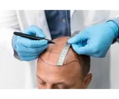 Best Hair Transplant Clinic Your Guide to Choosing the Right Hair Restoration Centre