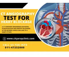 Best Diagnostic Centre For CT Coronary Angiography Test In Delhi