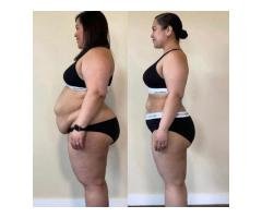 Weight Loss Treatments | Pills & Injections - 4