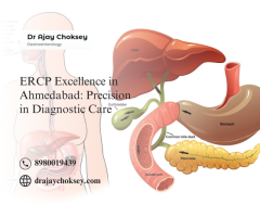 Affordable ERCP Test in Ahmedabad – Know More about Cost & Expert Care