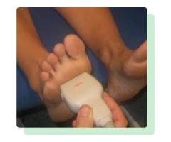 Wart On Bottom Of Foot Treatment Perth Amboy, NJ